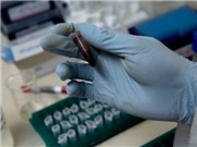 Mỹ cảnh báo virus chết người tới 10.000 du khách